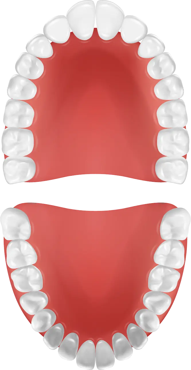 Modelo de dientes superior e inferior en La Clinica Dental Lindavista CDMX, representando opciones de tratamiento en implantolog&iacute;a dental.